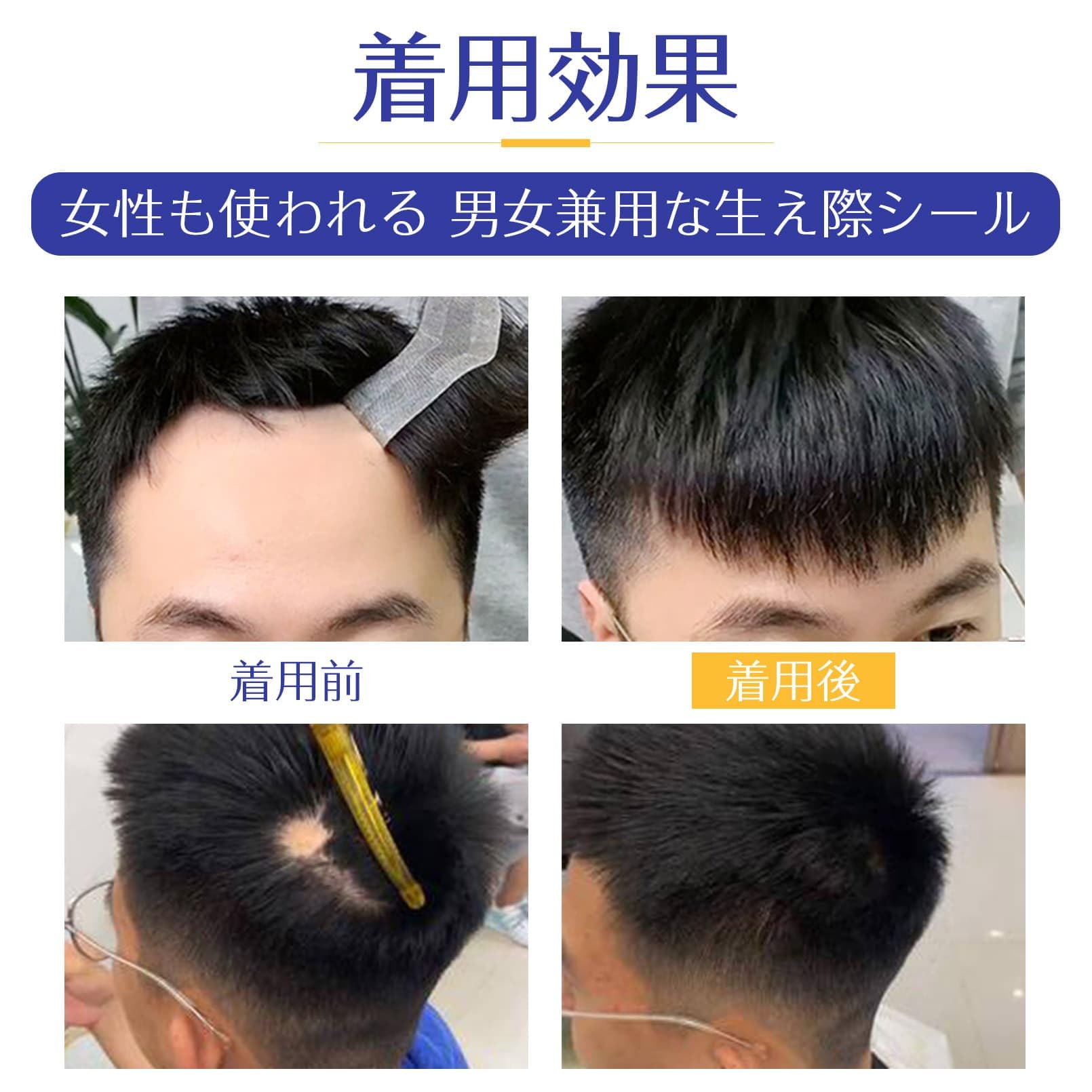 Amazon.co.jp: YOYO 貼る増毛 生え際 極薄タイプ 貼付け増毛 无痕 貼る